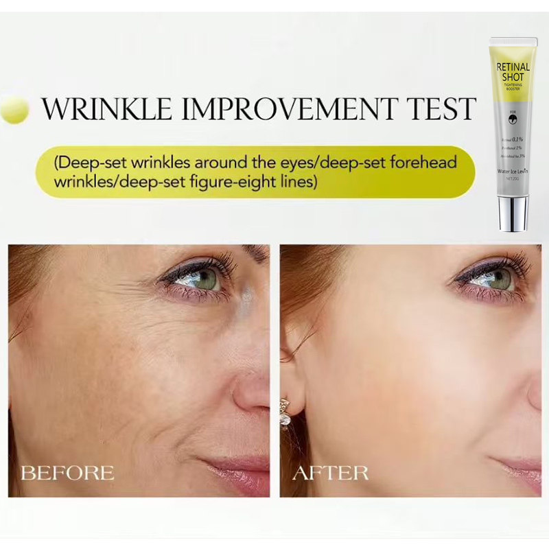 Retinal 0,1% Intensive Shot Pa - Retinol Anti Wrinkle Cream recensione e prezzo